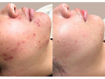 ウォナ(WONA)/【お客様症例】