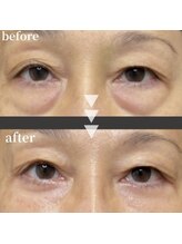 ハイナ 恵比寿店(Hi-Na)/恵比寿/フェイシャル/ブライダル