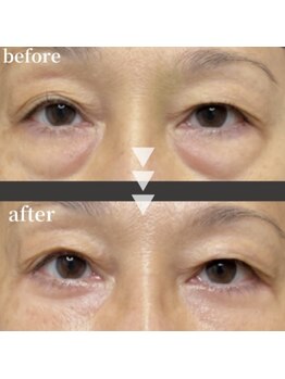 ハイナ 恵比寿店(Hi-Na)/恵比寿/フェイシャル/ブライダル