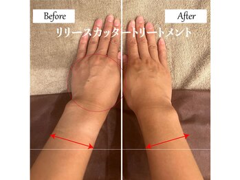 リノ(Lino)/上半身リリースカッター◎