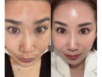 ウィズルーチェ つくばみどりの店(with luce)/美容家オーナーはノーファンデ♪