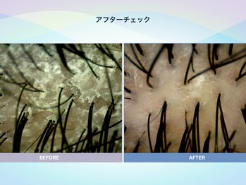 アンス(anth:)/お客様の仕上がり