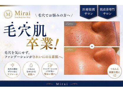 ミライ(Mirai)の写真