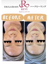 サロンドール(SalonDoll)/