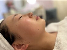 マリーゴールド(marigold)/◇marigoldフェイシャル