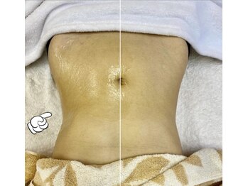 トータルエステサロン エステアンドメイク 錦糸町/当店痩身は結果とスピードが違う