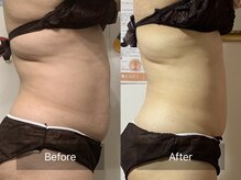 ピー ブリエ 弥富本店/ビフォーアフター