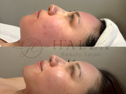 ハレア(HALEA)の写真