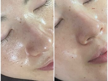 エムズ(M's)/Before /After