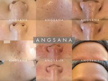 アンサナ 三軒茶屋(angsana)