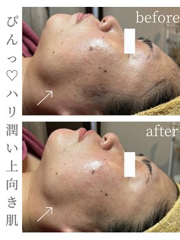 シストワ(sistoi)/たるみシワを引き締めて潤いも♪