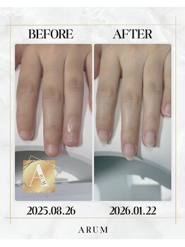 Luxury escape 自爪育成