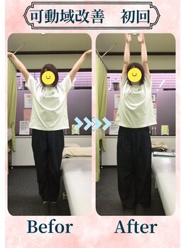 アミーゴ整体院/ビフォーアフター