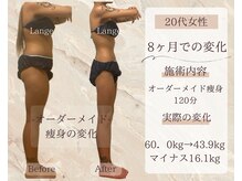サロン ド ボーテ ラーンジュ 岐阜店(salon de beaut'e L'ange)/ハイパ-ナイフEX2ダイエット痩身