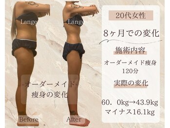 サロン ド ボーテ ラーンジュ 岐阜店(salon de beaut'e L'ange)/ハイパ-ナイフEX2ダイエット痩身