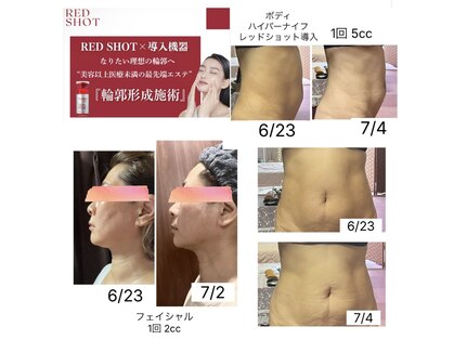 クマ ハウス(KUMA HOUSE)の写真