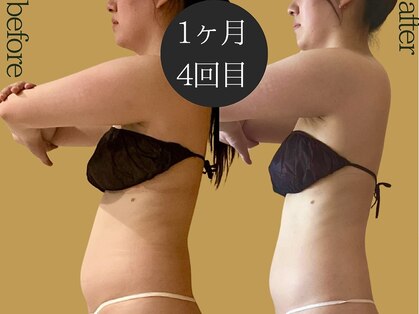 マルレ(MARLE)の写真