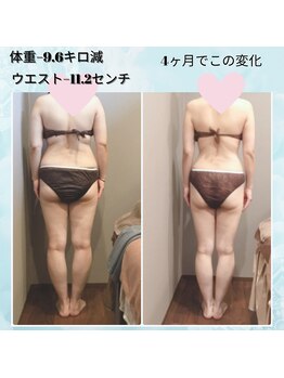 ムーン(MOON)/痩身全身コース