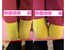 ボディステップ(BODY STEP)の雰囲気（20代/女性/末端冷え/むくみ/原因/足首歪み/股関節つまり ）