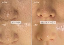 シューラディアント(ShuRadiant)