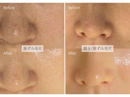 シューラディアント(ShuRadiant)の写真