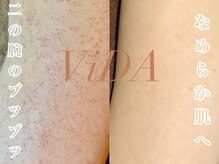 ヴィーダ 渋谷松濤(ViDA)の雰囲気（千葉・埼玉・神奈川・茨城・静岡からもご来店中★）