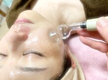 エレス(ELLES)/リンパパター