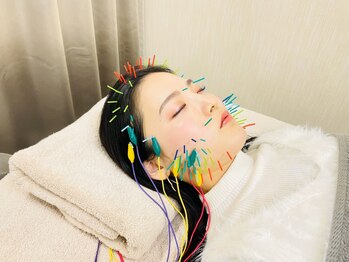 ぱるの写真/美容鍼が初心者の方にもおすすめ！プロによる美容鍼で【小顔×肌質改善】も叶う♪理想のお顔へ☆