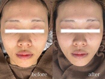 フェイン 青山店(fein.)/ダントツの白さとツヤ感!