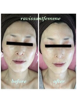 ラヴィソンファム(Ravissant femme)/40代1回効果/キメ/トーンUP