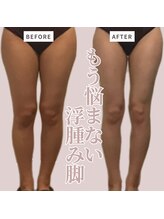 ソワン(Soin)/20代　下半身