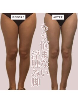 ソワン(Soin)/20代　下半身