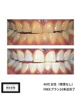 レオン 磐田(REON)/◇ お客様 before＆after ◇