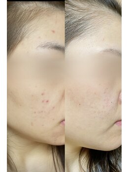 フィール 銀座(feel)/facial フェイシャルエステ