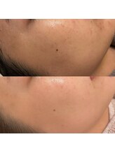 エクラ(eclat)/クリスティーナ