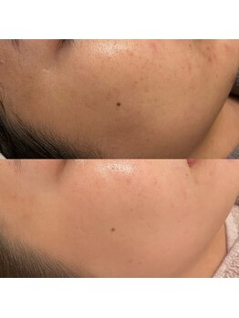 エクラ(eclat)/クリスティーナ