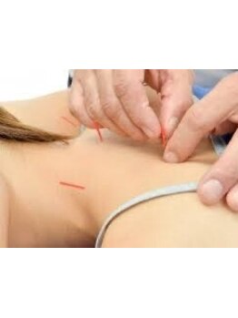 鍼灸施術を受けたい