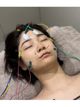 ミプラス鍼灸スタジオ/美容鍼