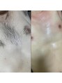 アンドエス 六本木(and S.) ワックス脱毛講師経験ありの豊富な経験でお客様の綺麗を叶えます