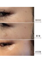 メディカルエース(MedicalAce)/スポット