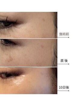 メディカルエース(MedicalAce)/スポット