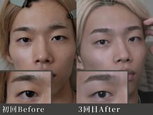 サブト 目黒(SUBT.)の雰囲気（骨格構造を基に、似合う眉を引き出します[目黒駅/メンズ眉毛]）