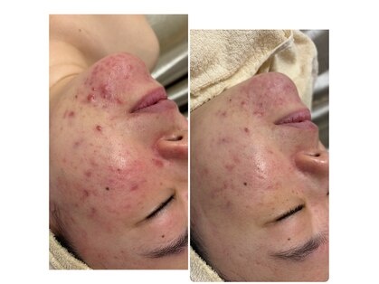 リノレア(Lino_Lea)の写真