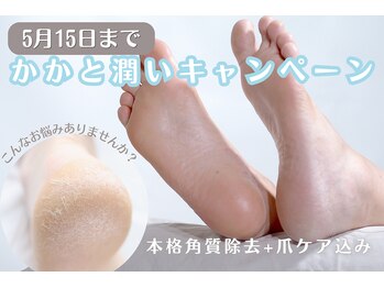 アイリス(iris)の写真/【彦根・能登川・八日市エリア】本格ケアで、ガサガサ解消◎夏前の"かかとリセット"で魅せれる素足♪