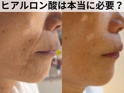 ハナコ 健軍店(HANAKO)の写真