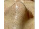 プリエ(PRIER)の写真/こんな毛穴になってませんか？毛穴の開きとブラックヘッドをケアしてすっきりキレイな毛穴へ♪