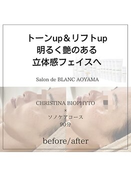 サロン ド ブラン アオヤマ(Salon de BLANC AOYAMA)/トーンup&リフトup！