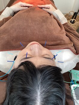 ハリファ鍼灸院 横浜関内院(HariFa鍼灸院)/美容施術