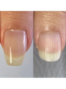 ラピスラズリ(lapislazuli)/◇自爪育成◇