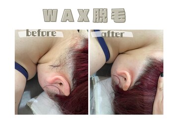 レヴィート(Revept)/【ワックス脱毛】